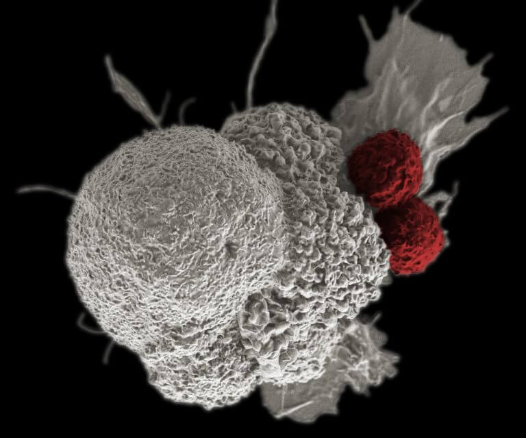 CAR T cells attack a cancer cell. Source: Rita Elena Serda, Duncan Comprehensive Cancer Center at Baylor College of Medicine, National Cancer Institute, National Institutes of Health.