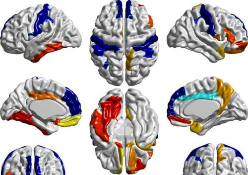 Early diagnosis of autism may improve the chances of success of future treatments. (Illustration: from the article by Hezelt and her colleagues, Nature, issue 542 - 348 | NATURE | VOL 542 | 16 FEBRUARY 2017 LETTERdoi:10.1038/nature21369 Early brain development in infants at high risk for autism spectrum disorder.