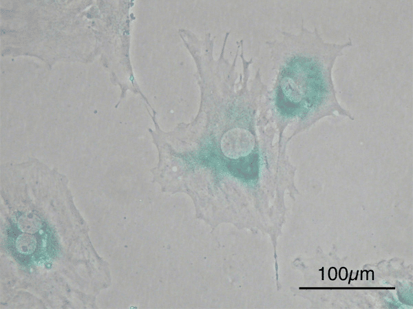 Photomicrograph of senescent cells in a mouse - cells that "retire" and stop dividing, but do not die - are always present and even play some important roles in the body, for example in wound healing. But in aging organs, these cells are not eliminated at the proper rate, and can accumulate and damage Source: Y tambe, Wikimedia.