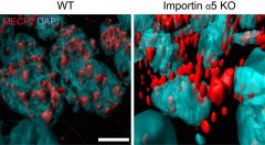 בעכברים מהונדסים גנטית, שחסרים את החלבון אימפורטין אלפא-5 (מימין), מולקולת ה-MeCP2 (באדום) המשפיעה על התנהגות חרדתית, נשארת מחוץ לגרעין (בכחול) של תאי העצב במוח, ולא חודרת לתוכו כמו בעכברים רגילים (משמאל). עיבוד ממוחשב של תמונה אשר צולמה באמצעות מיקרוסקופ קונפוקלי. מכון ויצמן