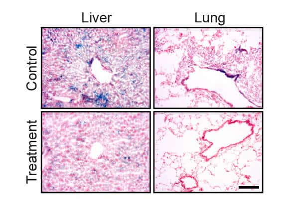 A significant decrease in the number of senescent cells (blue spots) in the liver and lung tissues of mice following the drug treatment