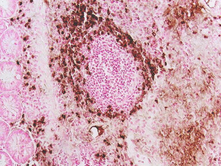 eosinophils. Photo: Prof. Ariel Munitz, Tel Aviv University