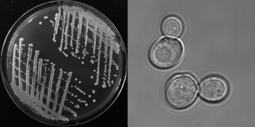  שמר האפייה, מודל למחקר ביולוגי, על מצע מזון מוצק (משמאל) ובהגדלה באמצעות מיקרוסקופ אור (ימין). קרדיט: Photo courtesy of Gazit Lab