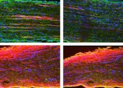צמיחה מחדש של שלוחות תאי עצב המוקפות בתאי גְלִייָה (גרעיני התאים מסומנים בכחול), בעצב השת של עכבר, שבעה ימים לאחר פציעה (למעלה) ו-25 ימים לאחריה (למטה). בעכברים ללא Silc1 (טור שמאלי), השיקום פחות עוצמתי – שלוחות תאי העצב שצמחו מחדש (אדום) קצרות יותר מאשר בעכברים בעלי עותק Silc1 פעיל. צולם באמצעות מיקרוסקופ פלואורסצנטי