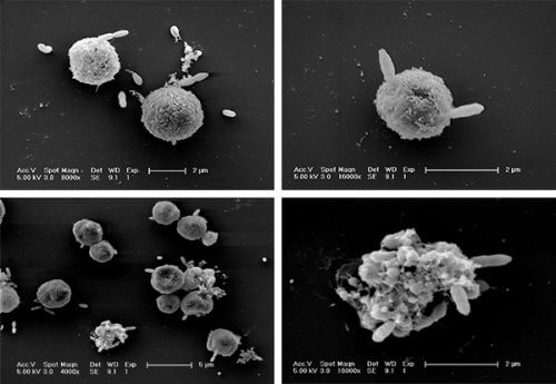 Sulfur-loving bacteria attack algae cells from Emiliania huxleyi Source, Prof. Assaf Vardi. Weizmann Institute