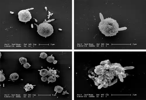 Sulfur-loving bacteria attack algae cells from Emiliania huxleyi Source, Prof. Assaf Vardi. Weizmann Institute