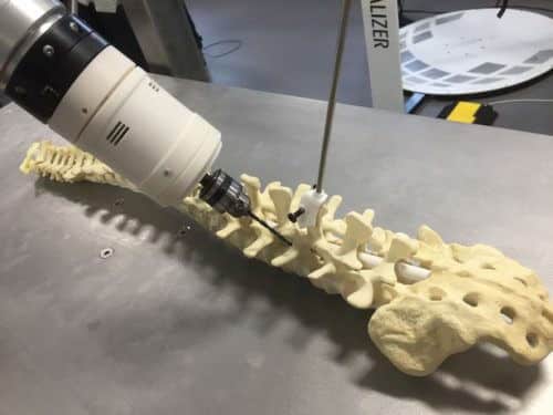 הרובוט מנתח עמוד השדרה שפותח ב-NTU. קרדיט: NTU UNIVERSITY