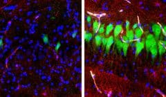 כתמי אימונופלורסנט עבור נוירונים (NeuN, ירוק), אסטרוציטים (GFAP, אדום) וגרעיני תאים (DAPI, כחול) באזור המוח של ה- H3 של המוח בהיפוקמפוס או unperfused במשך 10 שעות לאחר המוות (משמאל) ולאחר שימוש בטכנולוגית BrainEx (ימין). 10 שעות לאחר המוות, נוירונים ואסטרוציטים עוברים בדרך כלל התפוררות תאית, אלא אם כן מצילים אותם בעזרת מערכת BrainEx. קרדיט: סטפנו ג. דניאלה , Zvonimir Vrselja; מעבדת Sestan; בית הספר לרפואה, ייל