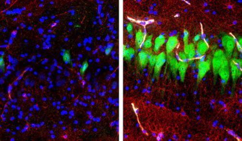  כתמי אימונופלורסנט עבור נוירונים (NeuN, ירוק), אסטרוציטים (GFAP, אדום) וגרעיני תאים (DAPI, כחול) באזור המוח של ה- H3 של המוח בהיפוקמפוס או unperfused במשך 10 שעות לאחר המוות (משמאל) ולאחר שימוש בטכנולוגית BrainEx (ימין). 10 שעות לאחר המוות, נוירונים ואסטרוציטים עוברים בדרך כלל התפוררות תאית, אלא אם כן מצילים אותם בעזרת מערכת BrainEx. קרדיט: סטפנו ג. דניאלה , Zvonimir Vrselja; מעבדת Sestan; בית הספר לרפואה, ייל