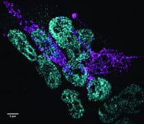 תאי גזע עובריים של עכבר נצפו באמצעות מיקרוסקופ קונפוקלי בעל דיסק מסתובב. רמות החלבון המונע מתאי גזע להתמיין (ירקרק) יורדות בנוכחותן של רמות גבוהות של חלבון אחר (סגול) אשר גורם למיטוכונדריה להתארך
