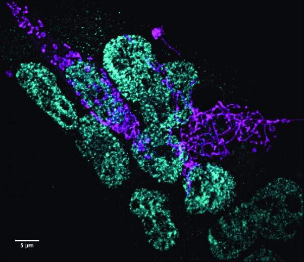 Mouse embryonic stem cells were observed using a spinning disk confocal microscope. The levels of the protein that prevents stem cells from differentiating (green) decrease in the presence of high levels of another protein (purple) that causes mitochondria to elongate