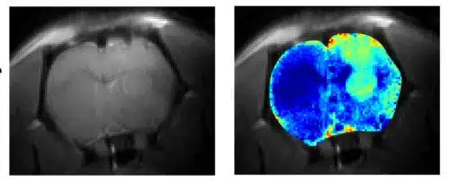 A rat brain injected with glioblastoma cells. Using MRI combined with the CEST method (right), it is possible to clearly distinguish between brain tissue that has changed its texture as a result of glioblastoma (light turquoise) and healthy tissue (blue). This difference cannot be seen on a normal MRI (left)