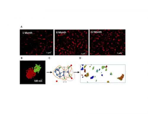 : Tracking the accumulation of alpha-synuclein deposits with the help of super-resolution microscopy and analysis that allows early detection of Parkinson's disease. Credit: Prof. Uri Ashari and Dr. Dana Bar-On