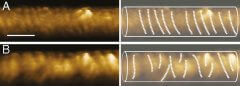 סליל הדינמין בתמונות מיקרוסקופ אלקטרונים. לפני הוספת מולקולות GTP המספקות אנרגיה למערכת, לדינאמין צורה של סליל רגיל (a). לאחר הוספת המולקולות GTP, זווית הנעיצה של חלבון משתנה, והחלבון נוטה ונשבר לחלקים בעלי צורה של סליל נטוי (b). צילום: דוברות הטכניון