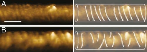 The dynamin coil in electron microscope images. Before the addition of GTP molecules that provide energy to the system, dynamin has the shape of a regular coil (a). After the GTP molecules are added, the angle of attachment of a protein changes, and the protein tilts and breaks into coiled-coil-shaped parts (b). Photo: Technion spokespeople