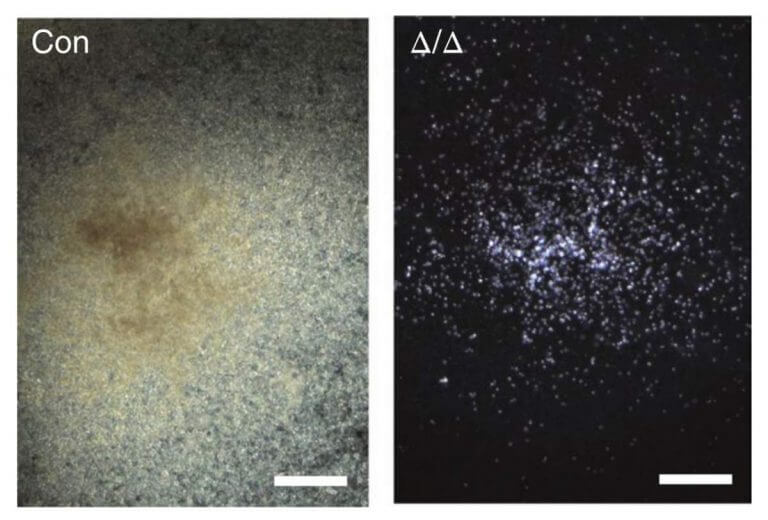 Mouse hematopoietic stem cells in culture. Right: the cells did not differentiate into blood cells after the activity of Mettl3 was disabled in them. On the left: the non-engineered stem cells differentiated in a short time into mature blood cells of different types