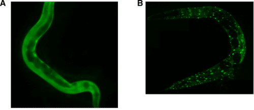 c.elegans worms in post trauma. Photo: The laboratories of Dr. Alon Zasalbar and Dr. Yifat Eliezer, The Hebrew University