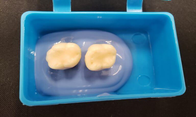 A model of a restored tooth with the original composite (left) and with the improved composite containing the antibacterial nanostructures (right). Credit: Lee Schneider, Tel Aviv University