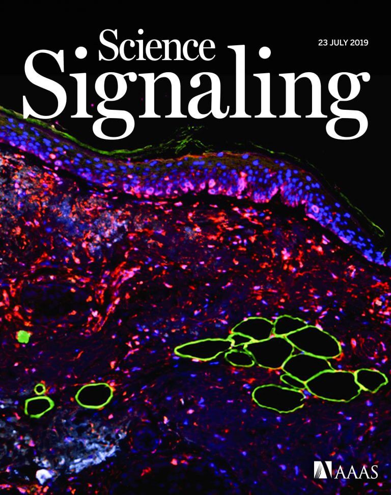 The cover image of the journal Science Signaling: a skin section of a melanoma sample stained with fluorescent dyes used as markers: melanoma cells (red), fat cell membrane (green) and skin cell nuclei (blue). Photography and coloring: Roma Parikh