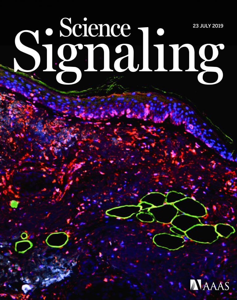 صورة الغلاف لمجلة Science Signaling: قسم جلدي من عينة سرطان الجلد ملطخة بأصباغ الفلورسنت المستخدمة كعلامات: خلايا سرطان الجلد (الأحمر)، غشاء الخلايا الدهنية (الأخضر)، ونواة خلايا الجلد (الأزرق). تصوير وتلوين: روما باريك