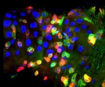 צילום מיקרוסקופ קונפוקלי: חתך במעי הזבוב הבוגר - תאי גזע העוברים התמיינות משובשת. צוותו של פרופ' אמיר אורין, הטכניון
