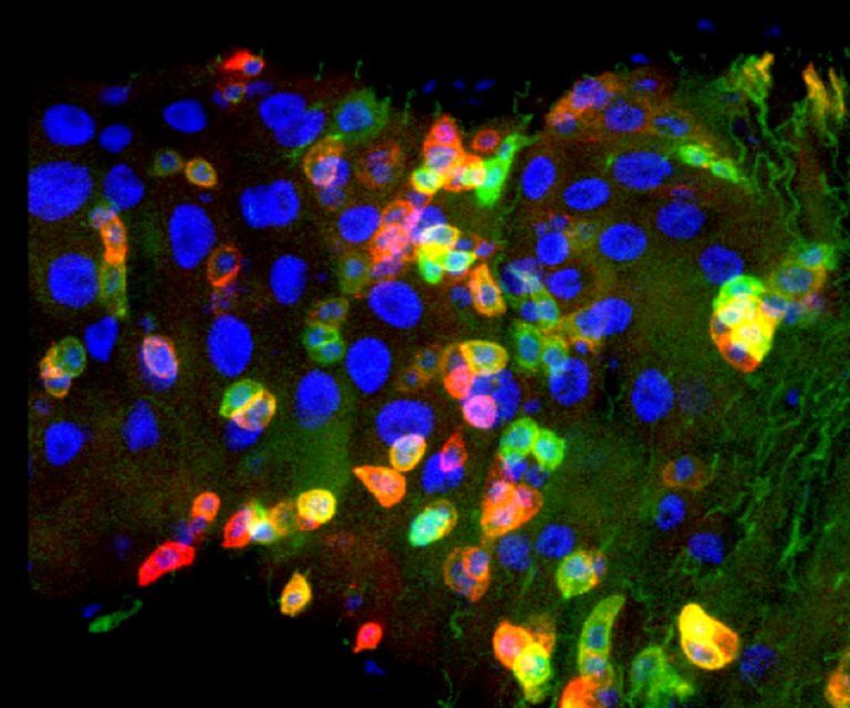 صورة مجهرية متحد البؤر: مقطع عرضي لأمعاء الذبابة البالغة - الخلايا الجذعية التي تعاني من ضعف التمايز. فريق البروفيسور أمير أورين التخنيون
