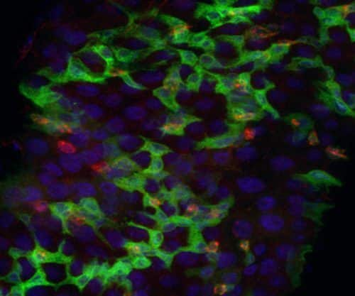 תמונה ממיקרוסקופ קונפוקלי: חתך במעי הזבוב הבוגר  - עודף תאי אב (אדומים וירוקים) עקב אובדן בקרה של הזהות הממוינת של תאי מעי בוגרים.צוותו של פרופ' אמיר אורין, הטכניון