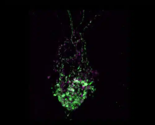 The hormone oxytocin (in purple) at the secretion points in the synapses (in green) in the transparent brain of a genetically modified zebrafish. Prof. Gil Levkovitch, Weizmann Institute