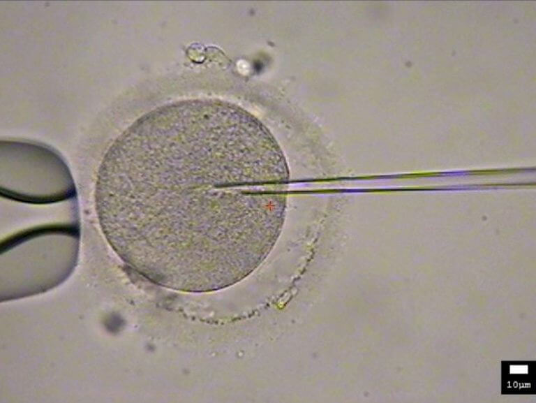 A fertilized egg is tested. Photo from the laboratory of Dr. Aryeh Musayouf. Credit - Dr. Assaf Ben Meir