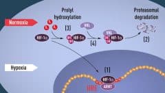 איור 1 כאשר רמות החמצן נמוכות (היפוקסיה), HIF-1α מוגן מפני פירוק ואז הוא מצטבר בגרעין התא, שם הוא חובר למרכיב ARNT ונקשר למקטעי דנ"א ספציפיים (HRE) בתוך גנים מווסתי היפוקסיה (1). ברמות חמצן רגילות, HIF-1α מתפרק במהירות על ידי מבנה הפרוטאוזום (2). החמצן מווסת את תהליך הפירוק על ידי הוספה של קבוצות הידרוקסיל (OH) למרכיב HIF-1α (3). בשלב זה יכול חלבון ה-VHL להיות מזוהה וליצור תצמיד עם HIF-1α, תוצאה המובילה לפירוקו באופן תלוי חמצן (4). איור: ועדת פרס נובל לרפואה