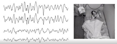 موجات النوم. رسم توضيحي: جامعة بن غوريون