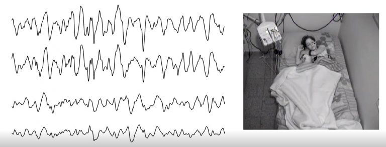 موجات النوم. رسم توضيحي: جامعة بن غوريون