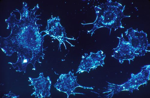 תאים סרטניים, אילוסטרציה. מקור: National Cancer Institute.