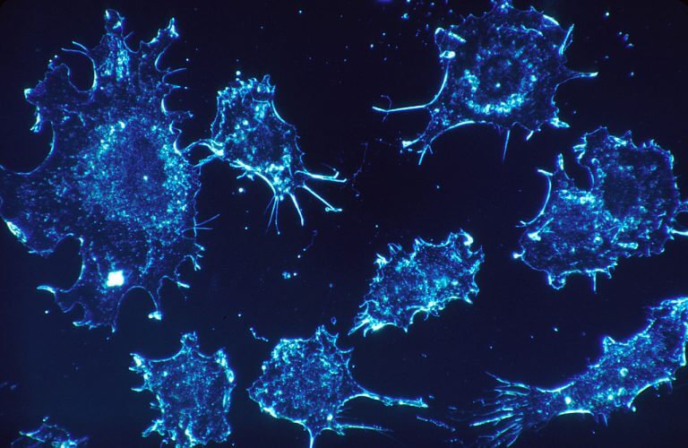 Cancer cells, illustration. Source: National Cancer Institute.