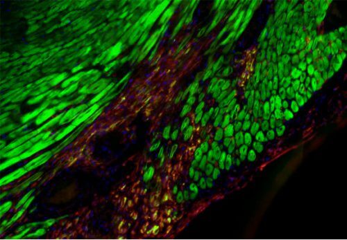 Myocardial infarction in the mouse. Marked in red - the cells of the immune system in the damaged area