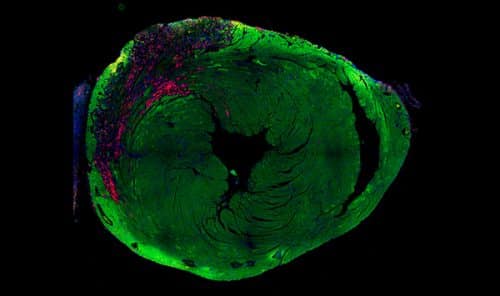 Cardiac muscle cell. The contracting fibers are marked in red, the cell nucleus - in blue