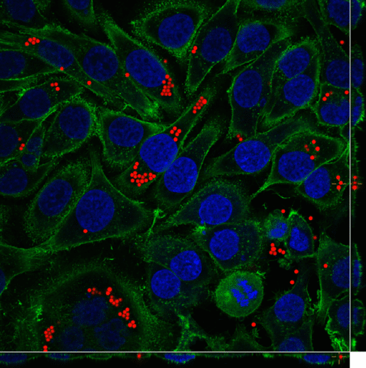 Violent cancer cells. Illustration, the lab of Dr. Ofra Bani, Hebrew University