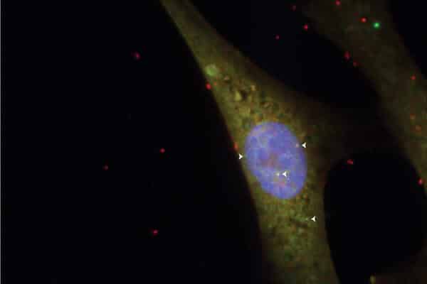 חלקים שונים של הגן צ'ייסר (נקודות המסומנות בחצים) מתבטאים בעיקר בגרעין התא של עובר עכבר (מסומן בכחול). עובדה זו תומכת בהשערה כי הצ'ייסר מעורב בבקרה על פעילות גנים