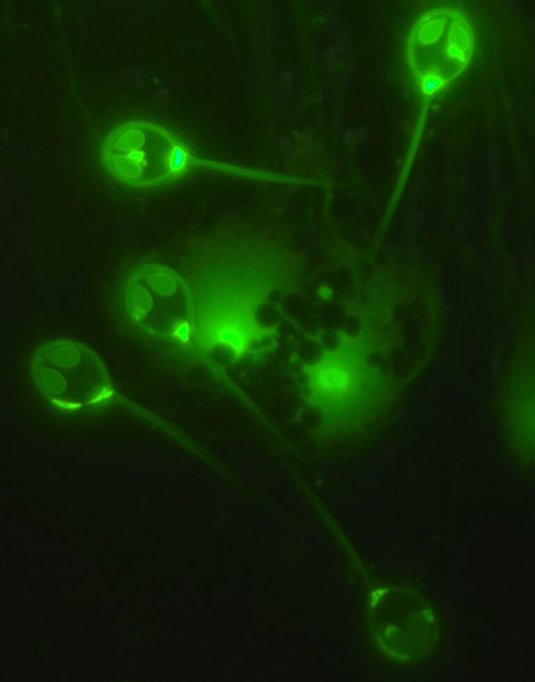 In the photo: a fluorescent image of the parasite's spores Photo: Prof. Stephen D. Atkinson (Oregon State University, OR