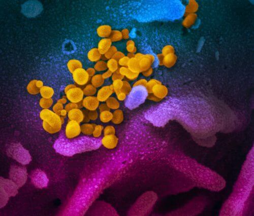 يظهر فيروس كورونا الجديد الذي يسبب مرض كوفيد-19 (الأصفر) على سطح الخلايا (الأزرق/الوردي) في المزرعة في المختبر. مختبرات NIAID (RML)، الولايات المتحدة الأمريكية NIH، CC BY NIAID Rocky Mountain
