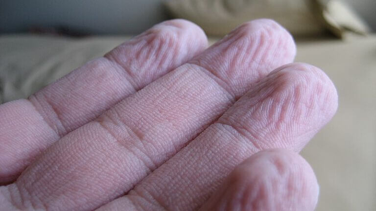 Wrinkled fingers. Photo: Brenderous, Wikimedia