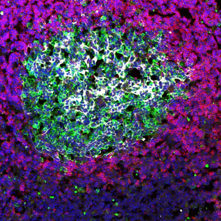 A niche inside a lymph node where the antibody-producing cells are formed. The laboratory of Prof. Ziv Shulman