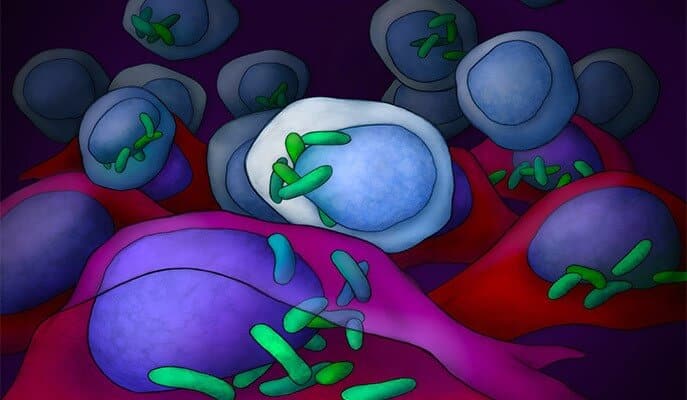تؤسس البكتيريا (باللون الأخضر) موطنًا لها في الخلايا السرطانية وتستقر بشكل مريح في منطقة نواة الخلية. المصدر: معهد وايزمان