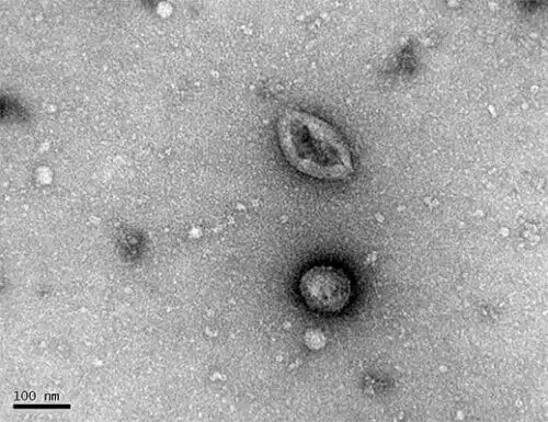 Nanobubbles secreted by bilateria under a penetrating electron microscope
