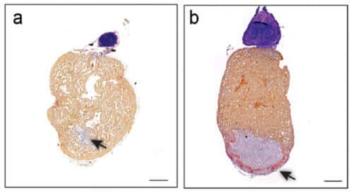 Cross section of the zebrafish heart 30 days after injury. The injured site (marked by an arrow) without a scar in a fish with normal lymphatic vessels (left) but not in a mutant fish that does not have these vessels (right)