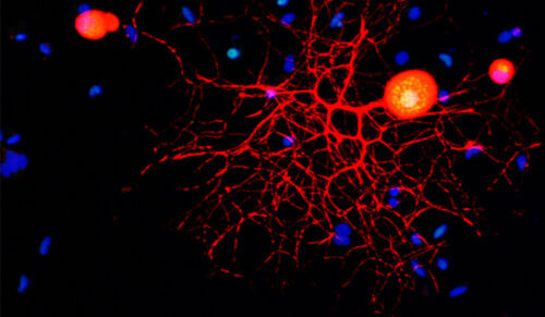 Confocal microscopy image of sensory neurons of the peripheral nervous system in culture (the cells and their extensions are marked in red). You can see in the neurons a combination of colors (blue-red-green) created as a result of marking the cell nuclei in blue and marking the transcription factor c-Fos in green. The scientists discovered that c-Fos is introduced into the nuclei by means of importin alpha-3 (the blue markings around - nuclei of other types of cells that are also in the culture)