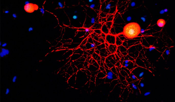 תמונת מיקרוסקופיה קונפוקלית של תאי עצב תחושתיים של מערכת העצבים ההיקפית בתרבית (התאים ושלוחותיהם מסומנים באדום). ניתן לראות בתאי העצב שילוב צבעים (כחול-אדום-ירוק) הנוצר כתוצאה מסימון גרעיני התאים בכחול וסימון גורם השעתוק c-Fos בירוק. המדענים גילו כי c-Fos מוכנס לגרעינים באמצעות אימפורטין אלפא-3 (הסימונים בכחול מסביב – גרעיני תאים מסוגים אחרים הנמצאים אף הם בתרבית)