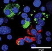 תאים מתוכנתים מחדש: תאי בטא המייצרים אינסולין (מסומן בירוק) ו"קרובי משפחתם" – תאי דלתא המייצרים סומטוסטטין (מסומן באדום). תאים המתוכנתים מחדש מכילים לרוב שני גרעינים (מסומנים בכחול) – עדות לכך שהם במקורם תאים אקסוקריניים. מעבדתו של פרופ' מייקל ווקר, מכון ויצמן