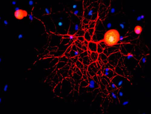 صورة مجهرية متحد البؤر للخلايا العصبية الحسية للجهاز العصبي المحيطي في الثقافة. بإذن من معهد وايزمان