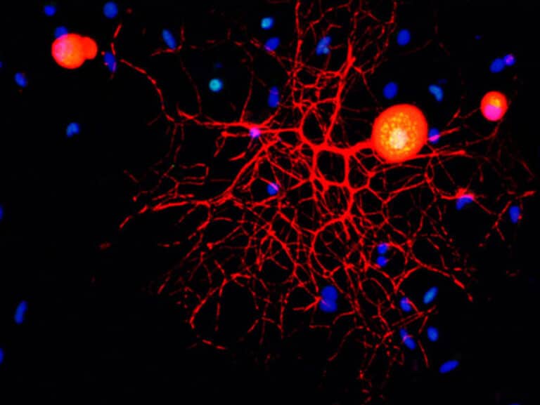 Confocal microscopy image of peripheral nervous system sensory neurons in culture. Courtesy of the Weizmann Institute